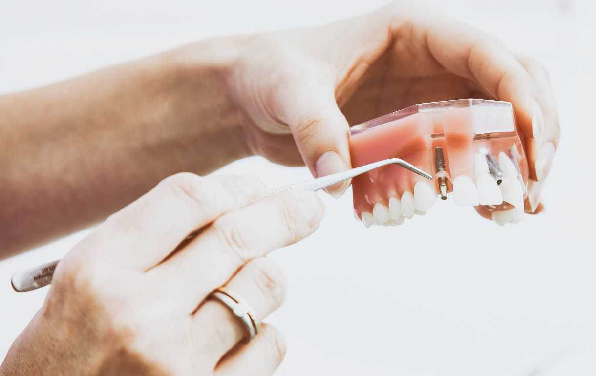 services dental implants procedure 01